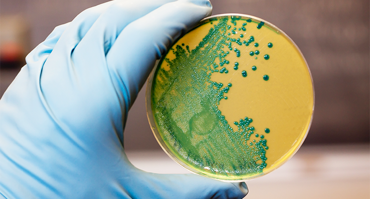 Discovery of New Listeria Species and Its Effect on EMPs
