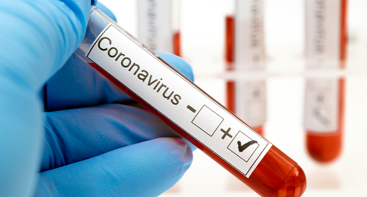 What to Do if an Employee Tests Positive for COVID-19